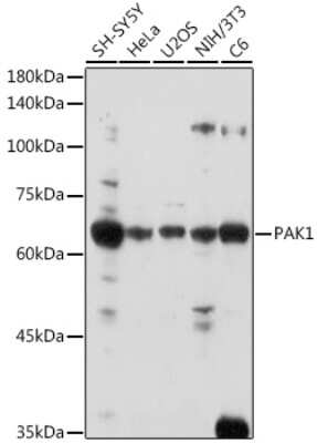 Western Blot: PAK1 AntibodyBSA Free [NBP2-95108]